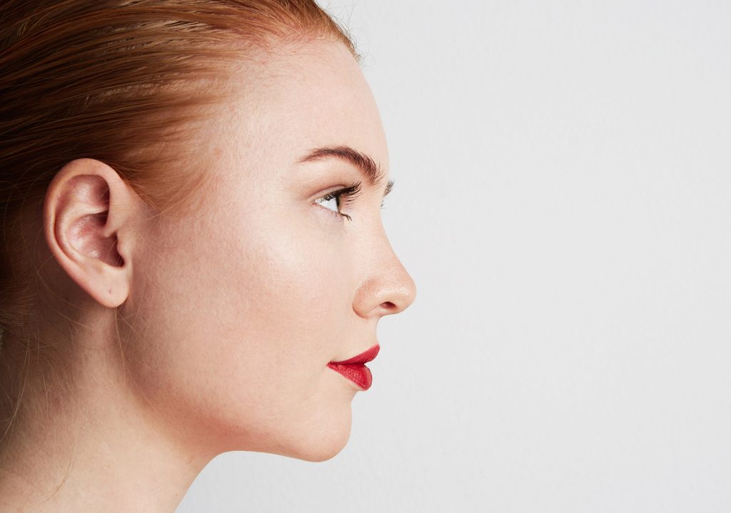 perfiloplastia