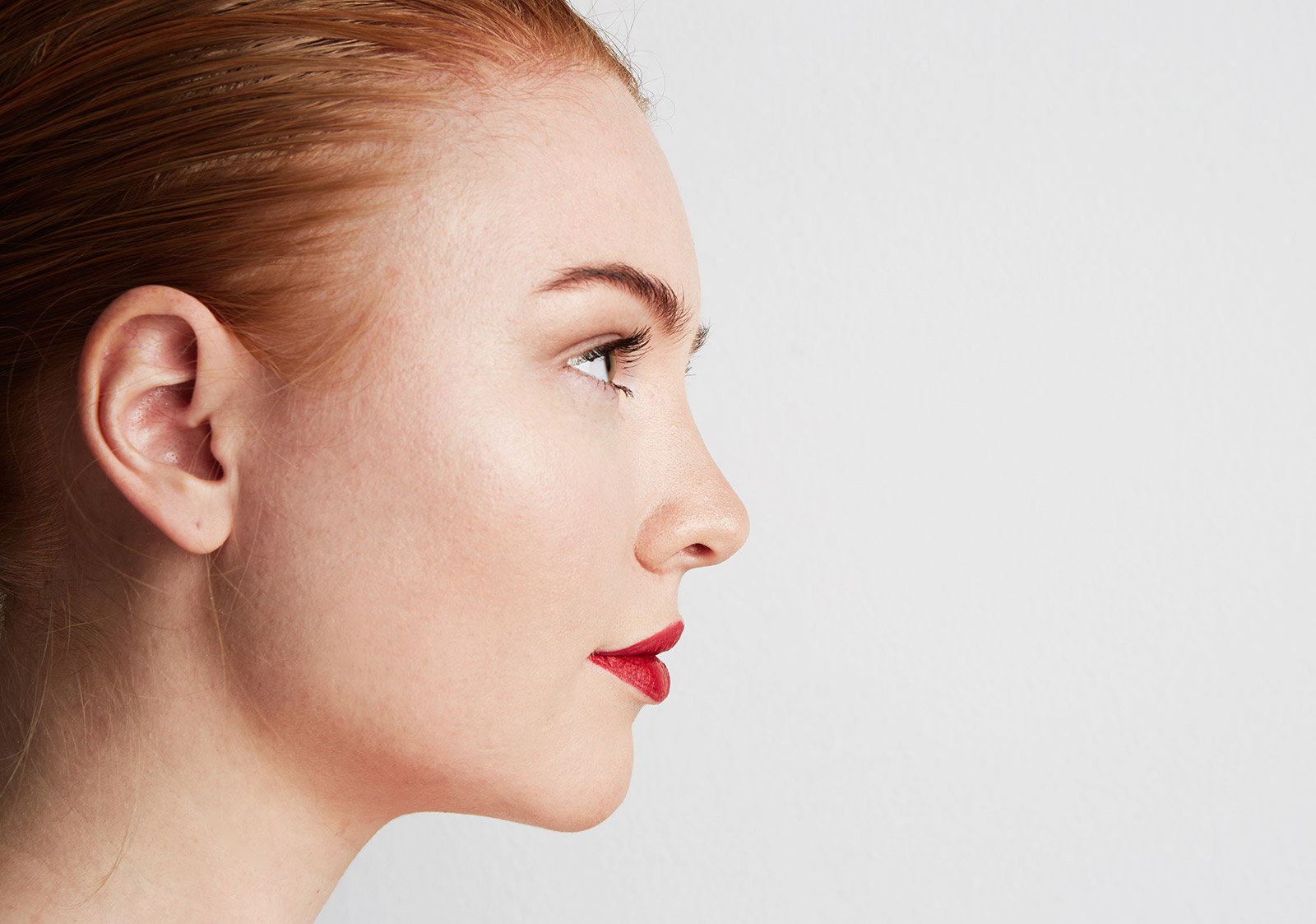 perfiloplastia